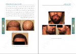 دانلود پی دی اف کاشت موی طبیعی علی وفایی 186 صفحه PDF-1
