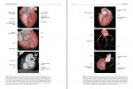 دانلود پی دی اف MDCT Anatomy Body Giuseppe Brancato Luigia Romano Massimo Silva 220 صفحه PDF-1